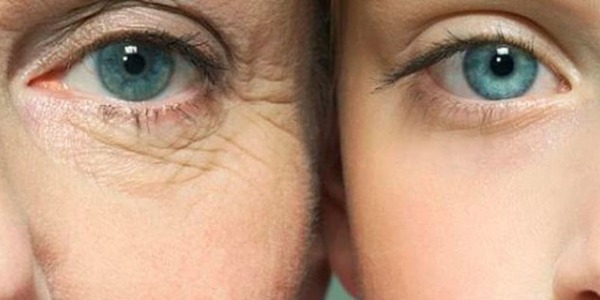 ARRUGAS EN LAS OJERAS – ¿CÓMO ACTUAR PARA NO TENERLAS?