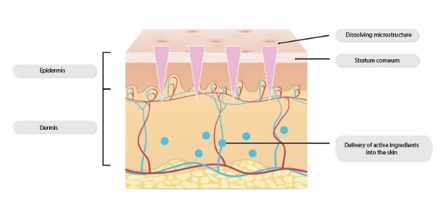 DROPLET-BORN AIR BLOWING: LA TÉCNICA DE FABRICACIÓN DE LOS PARCHES DE FACTOR SKIN 53